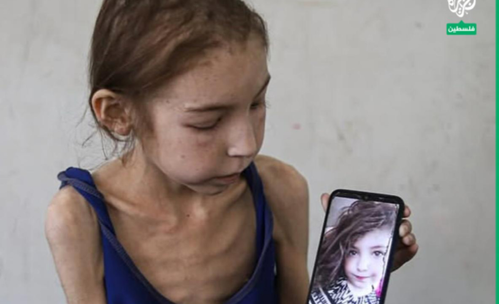 غزة تموت جوعًا