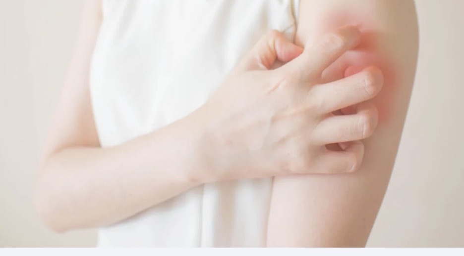 عدوى جديدة تثير المخاوف… والقلق يرافق ظهورها في لبنان: لا داعي للهلع!